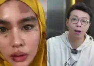 Richard Lee Tanggapi Muka Kartika Putri Alami Ruam hingga Melepuh