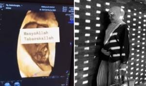 Kabar Bahagia, Zaskia Sungkar Hamil Anak Kedua: Begini Potret Usg Pertamanya 1 Kabar Bahagia, Zaskia Sungkar Hamil Anak Kedua: Begini Potret Usg Pertamanya