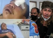 Polisi Tetapkan Bahar Bin Smith Tersangka, Anggota Banser Alami Luka Parah
