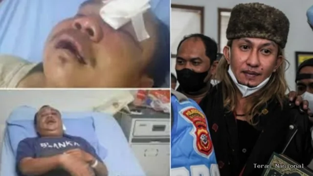 Polisi Tetapkan Bahar Bin Smith Tersangka, Anggota Banser Alami Luka Parah